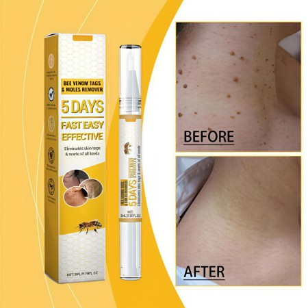 Bee Venom Tag & Moles Remover